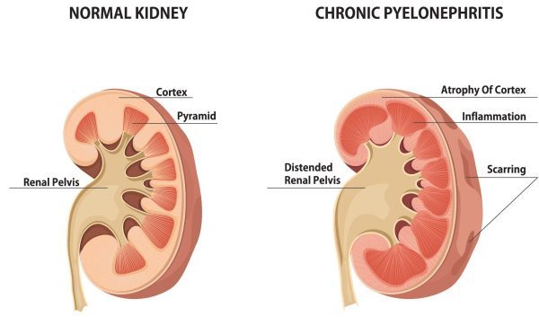 Gut Stasis AND Kidney Infection - Bay Area Bird & Exotics Hospital